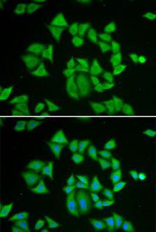 GSTM2 Antibody - Immunofluorescence analysis of A549 cells using GSTM2 antibody. Blue: DAPI for nuclear staining.