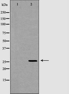 GSTM2 Antibody - Western blot analysis of HeLa whole cells lysates using GSTM2 antibody. The lane on the left is treated with the antigen-specific peptide.