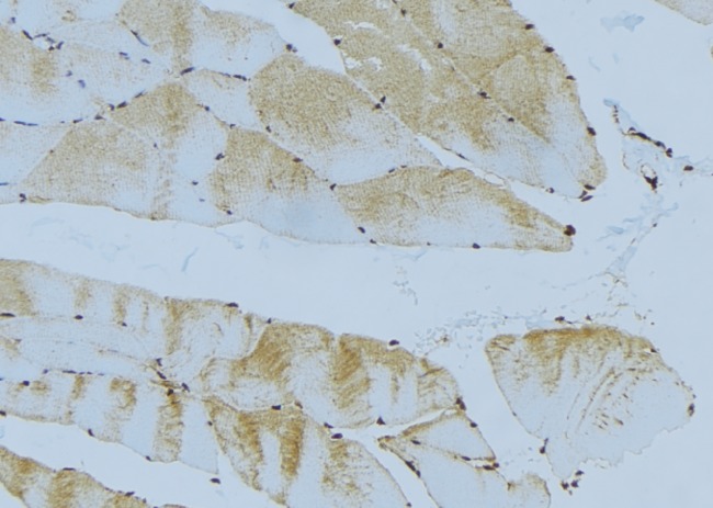 GSTM2 Antibody - 1:100 staining mouse muscle tissue by IHC-P. The sample was formaldehyde fixed and a heat mediated antigen retrieval step in citrate buffer was performed. The sample was then blocked and incubated with the antibody for 1.5 hours at 22°C. An HRP conjugated goat anti-rabbit antibody was used as the secondary.