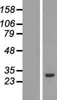 GSTM2 Protein - Western validation with an anti-DDK antibody * L: Control HEK293 lysate R: Over-expression lysate