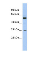 GSTM3 Antibody - GSTM3 antibody Western blot of Fetal Stomach lysate. This image was taken for the unconjugated form of this product. Other forms have not been tested.