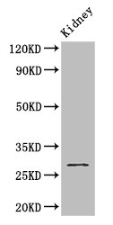 GSTM3 Antibody - Positive WB detected in:Mouse kidney tissue;All lanes: GSTM3 antibody at 2.8ug/ml;Secondary;Goat polyclonal to rabbit IgG at 1/50000 dilution;Predicted band size: 27 kDa;Observed band size: 27 kDa;