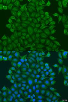 GSTM3 Antibody - Immunofluorescence analysis of U2OS cells using GSTM3 Polyclonal Antibody at dilution of 1:100.Blue: DAPI for nuclear staining.