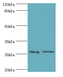 GSTM4-4 / GSTM4 Antibody - Western blot. All lanes: GSTM4 antibody at 10 ug/ml. Lane 1: Rat lung tissue. Lane 2: MCF-7 whole cell lysate. Secondary antibody: Goat polyclonal to rabbit at 1:10000 dilution. Predicted band size: 26 kDa. Observed band size: 26 kDa.
