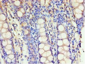 GSTM4-4 / GSTM4 Antibody - Immunohistochemistry of paraffin-embedded human rectum tissue using antibody at 1:100 dilution.