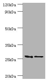 GSTM4-4 / GSTM4 Antibody - Western blot All lanes: GSTM4 antibody at 10µg/ml Lane 1: Rat lung tissue Lane 2: MCF-7 whole cell lysate Secondary Goat polyclonal to rabbit IgG at 1/10000 dilution Predicted band size: 26, 23, 19 kDa Observed band size: 26 kDa
