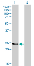GSTM4-4 / GSTM4 Antibody - Western Blot analysis of GSTM4 expression in transfected 293T cell line by GSTM4 monoclonal antibody (M01), clone 4B4.Lane 1: GSTM4 transfected lysate(25.6 KDa).Lane 2: Non-transfected lysate.