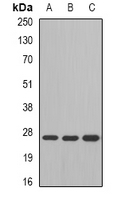 GSTM4-4 / GSTM4 Antibody - Western blot analysis of GSTM4 expression in SW480 (A); mouse liver (B); mouse lung (C) whole cell lysates.