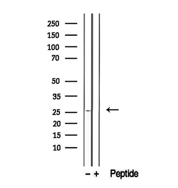 GSTM4-4 / GSTM4 Antibody - Western blot analysis of extracts of mouse lung tissue using GSTM4 antibody.