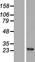 GSTM4-4 / GSTM4 Protein - Western validation with an anti-DDK antibody * L: Control HEK293 lysate R: Over-expression lysate