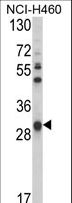 GSTO1 Antibody - Western blot of GSTO1 Antibody in NCI-H460 cell line lysates (35 ug/lane). GSTO1 (arrow) was detected using the purified antibody.