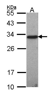 GSTO1 Antibody - Sample (30 ug of whole cell lysate). A: Hep G2 . 12% SDS PAGE. GSTO1 antibody diluted at 1:1000.