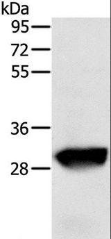 GSTO1 Antibody - Western blot analysis of Human liver cancer tissue, using GSTO1 Polyclonal Antibody at dilution of 1:200.