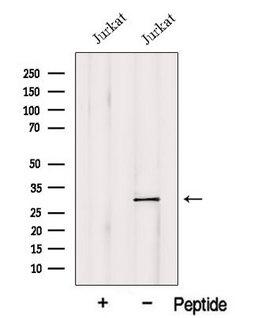GSTO1 Antibody - Western blot analysis of extracts of Jurkat cells using GSTO1 antibody. The lane on the left was treated with blocking peptide.