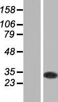 GSTO1 Protein - Western validation with an anti-DDK antibody * L: Control HEK293 lysate R: Over-expression lysate