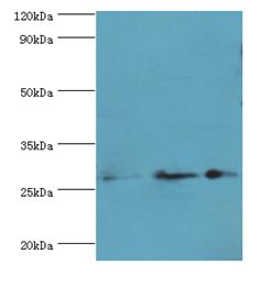 GSTO2 Antibody - Western blot. All lanes: GSTO2 antibody at 3 ug/ml. Lane 1: mouse skeletal muscle tissue. Lane 2: mouse kidney tissue. Lane 3: mouse liver tissue. Secondary antibody: Goat polyclonal to rabbit at 1:10000 dilution. Predicted band size: 28 kDa. Observed band size: 28 kDa.