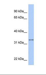 GSTO2 Antibody - Hela cell lysate. Antibody concentration: 1.0 ug/ml. Gel concentration: 12%.  This image was taken for the unconjugated form of this product. Other forms have not been tested.