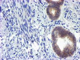 GSTO2 Antibody - IHC of paraffin-embedded Human endometrium tissue using anti-GSTO2 mouse monoclonal antibody.