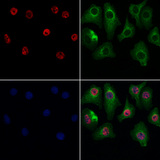 GSTO2 Antibody - Staining HeLa cells by IF/ICC. The samples were fixed with PFA and permeabilized in 0.1% Triton X-100, then blocked in 10% serum for 45 min at 25°C. Samples were then incubated with primary Ab(1:200) and mouse anti-beta tubulin Ab(1:200) for 1 hour at 37°C. An AlexaFluor594 conjugated goat anti-rabbit IgG(H+L) Ab(1:200 Red) and an AlexaFluor488 conjugated goat anti-mouse IgG(H+L) Ab(1:600 Green) were used as the secondary antibod