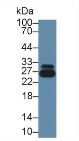 GSTP1 / GST Pi Antibody - Western Blot; Sample: Human Serum; Primary Ab: 1µg/ml Rabbit Anti-Human GSTp Antibody Second Ab: 0.2µg/mL HRP-Linked Caprine Anti-Rabbit IgG Polyclonal Antibody (Catalog: SAA544Rb19