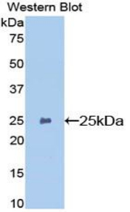 GSTP1 / GST Pi Antibody - Western blot of recombinant GSTP1 / GST Pi.  This image was taken for the unconjugated form of this product. Other forms have not been tested.
