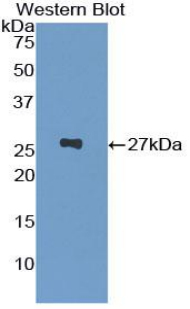 GSTP1 / GST Pi Antibody - Western blot of recombinant GSTP1 / GST Pi.  This image was taken for the unconjugated form of this product. Other forms have not been tested.