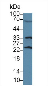 GSTP1 / GST Pi Antibody - Western Blot; Sample: Rat Serum; Primary Ab: 3µg/ml Rabbit Anti-Rat GSTp Antibody Second Ab: 0.2µg/mL HRP-Linked Caprine Anti-Rabbit IgG Polyclonal Antibody (Catalog: SAA544Rb19