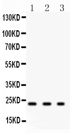 GSTP1 / GST Pi Antibody - Anti-GST3/GST pi antibody,Western blotting All lanes: Anti GST3/GST pi at 0.5ug/ml Lane 1: Rat Kidney Tissue Lysate at 50ugLane 2: HELA Whole Cell Lysate at 40ugLane 3: COLO320 Whole Cell Lysate at 40ugPredicted bind size: 23KD Observed bind size: 23KD