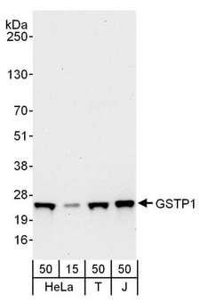 GSTP1 / GST Pi Antibody - Detection of Human GSTP1 by Western Blot. Samples: Whole cell lysate from HeLa (15 and 50 ug), 293T (T; 50 ug) and Jurkat (J; 50 ug) cells. Antibodies: Affinity purified rabbit anti-GSTP1 antibody used for WB at 0.1 ug/ml. Detection: Chemiluminescence with an exposure time of 30 seconds.