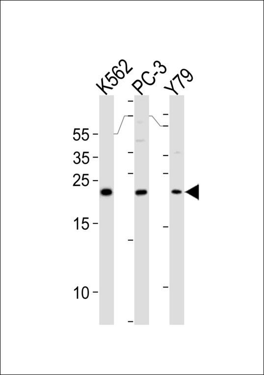 GSTP1 / GST Pi Antibody - GSTP1 Antibody western blot of K562,PC-3,Y79 cell line lysates (35 ug/lane). The GSTP1 antibody detected the GSTP1 protein (arrow).