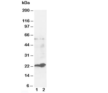 GSTP1 / GST Pi Antibody - Western blot testing of GST pi antibody and Lane 1: MCF-7; 2: COLO320 cell lysate