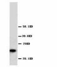 GSTP1 / GST Pi Antibody -  This image was taken for the unconjugated form of this product. Other forms have not been tested.