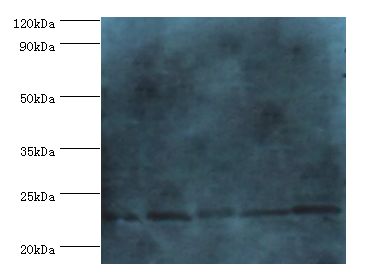 GSTP1 / GST Pi Antibody - Western blot. All lanes: Glutathione S-transferase P 1 antibody at 2 ug/ml. Lane 1: mouse kidney tissue Lane 2: Jurkat whole cell lysate Lane 3: k562 whole cell lysate Lane 4: 293T whole cell lysate Lane 5: HeLa whole cell lysate. Secondary antibody: goat polyclonal to rab.  This image was taken for the unconjugated form of this product. Other forms have not been tested.