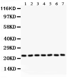 GSTP1 / GST Pi Antibody - GST3/GST pi antibody Western blot. All lanes: Anti GST3/GST pi at 0.5 ug/ml. Lane 1: Rat Brain Tissue Lysate at 50 ug. Lane 2: Rat Kidney Tissue Lysate at 50 ug. Lane 3: Rat Liver Tissue Lysate at 50 ug. Lane 4: HeLa Whole Cell Lysate at 40 ug. Lane 5: HT1080 Whole Cell Lysate at 40 ug. Lane 6: MCF-7 Whole Cell Lysate at 40 ug. Lane 7: SW620 Whole Cell Lysate at 40 ug. Predicted band size: 23 kD. Observed band size: 23 kD.