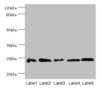 GSTP1 / GST Pi Antibody - Western blot All lanes: Glutathione S-transferase P 1 antibody at 2µg/ml Lane 1: Mouse kidney tissue Lane 2: jurkat whole cell lysate Lane 3: k562 whole cell lysate Lane 4: 293T whole cell lysate Lane 5: Hela whole cell lysate Secondary Goat polyclonal to rabbit IgG at 1/10000 dilution Predicted band size: 23 kDa Observed band size: 23 kDa