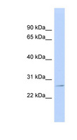 GSTP1 / GST Pi Antibody - GSTP1 antibody Western blot of Jurkat lysate. This image was taken for the unconjugated form of this product. Other forms have not been tested.