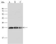 GSTP1 / GST Pi Antibody - Anti-GSTP1 rabbit monoclonal antibody at 1:500 dilution. Lane A: Jurkat Whole Cell Lysate. Lane B: K562 Whole Cell Lysate. Lane C: HeLa Whole Cell Lysate. Lysates/proteins at 30 ug per lane. Secondary: Goat Anti-Rabbit IgG (H+L)/HRP at 1/10000 dilution. Developed using the ECL technique. Performed under reducing conditions. Predicted band size: 23 kDa.