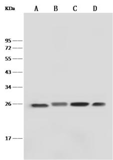 GSTP1 / GST Pi Antibody - Anti-GSTP1 rabbit monoclonal antibody at 1:500 dilution. Lane A: Jurkat Whole Cell Lysate. Lane B: K562 Whole Cell Lysate. Lane C: Molt-4 Whole Cell Lysate. Lane D: HeLa Whole Cell Lysate. Lysates/proteins at 30 ug per lane. Secondary: Goat Anti-Rabbit IgG (H+L)/HRP at 1/10000 dilution. Developed using the ECL technique. Performed under reducing conditions. Predicted band size: 23 kDa.