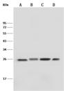 GSTP1 / GST Pi Antibody - Anti-GSTP1 rabbit monoclonal antibody at 1:500 dilution. Lane A: Jurkat Whole Cell Lysate. Lane B: K562 Whole Cell Lysate. Lane C: Molt-4 Whole Cell Lysate. Lane D: HeLa Whole Cell Lysate. Lysates/proteins at 30 ug per lane. Secondary: Goat Anti-Rabbit IgG (H+L)/HRP at 1/10000 dilution. Developed using the ECL technique. Performed under reducing conditions. Predicted band size: 23 kDa.