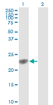 GSTP1 / GST Pi Antibody - Western Blot analysis of GSTP1 expression in transfected 293T cell line by GSTP1 monoclonal antibody (M01), clone 2G6-F6.Lane 1: GSTP1 transfected lysate (Predicted MW: 23.3 KDa).Lane 2: Non-transfected lysate.