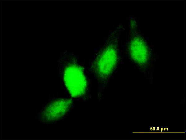 GSTP1 / GST Pi Antibody - Immunofluorescence of monoclonal antibody to GSTP1 on HeLa cell. [antibody concentration 10 ug/ml]