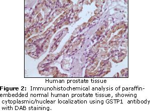 GSTP1 / GST Pi Antibody