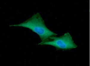 GSTP1 / GST Pi Antibody - ICC/IF analysis of GSTP1 in A549 cells line, stained with DAPI (Blue) for nucleus staining and monoclonal anti-human GSTP1 antibody (1:100) with goat anti-mouse IgG-Alexa fluor 488 conjugate (Green).