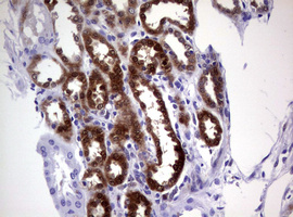 GSTP1 / GST Pi Antibody - IHC of paraffin-embedded Human Kidney tissue using anti-GSTP1 mouse monoclonal antibody. (Heat-induced epitope retrieval by 10mM citric buffer, pH6.0, 120°C for 3min).