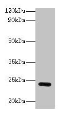 GSTP1 / GST Pi Antibody - Western blot All lanes: Glutathione S-transferase P antibody at 2µg/ml Lane 1: Jurkat whole cell lysate Lane 2: Hela hole cell lysate Secondary Goat polyclonal to rabbit IgG at 1/10000 dilution Predicted band size: 23 kDa Observed band size: 23 kDa