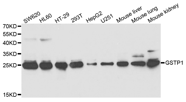 GSTP1 / GST Pi Antibody - Western blot analysis of extracts of various cell lines.