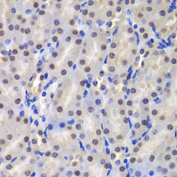 GSTP1 / GST Pi Antibody - Immunohistochemistry of paraffin-embedded mouse kidney tissue.
