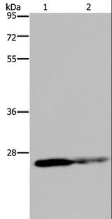 GSTP1 / GST Pi Antibody - Western blot analysis of HT-29 cell and human fetal brain tissue, using GSTP1 Polyclonal Antibody at dilution of 1:350.