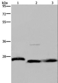 GSTP1 / GST Pi Antibody - Western blot analysis of Human placenta tissue, HT-29 cell and human fetal brain tissue, using GSTP1 Polyclonal Antibody at dilution of 1:300.