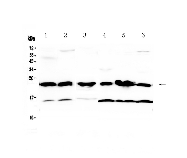 GSTP1 / GST Pi Antibody - Western blot - Anti-GST3 / GST pi Picoband Antibody